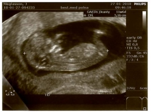 ultrasound, baby